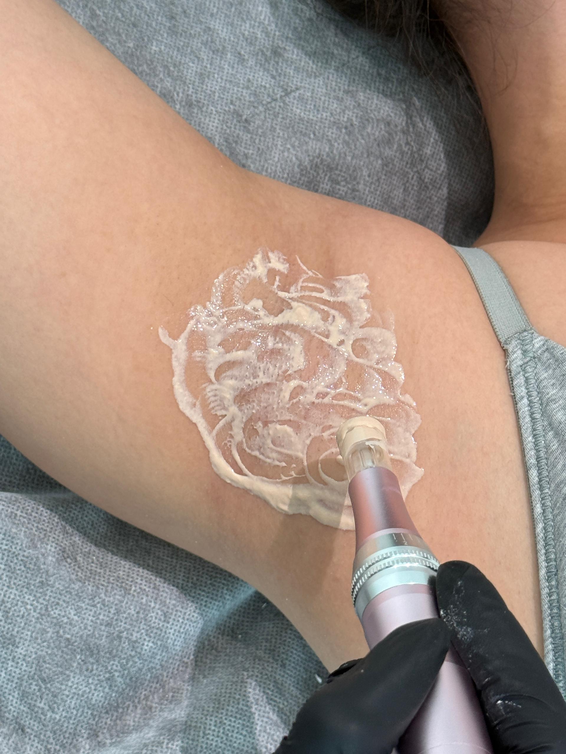 Nano Whitening