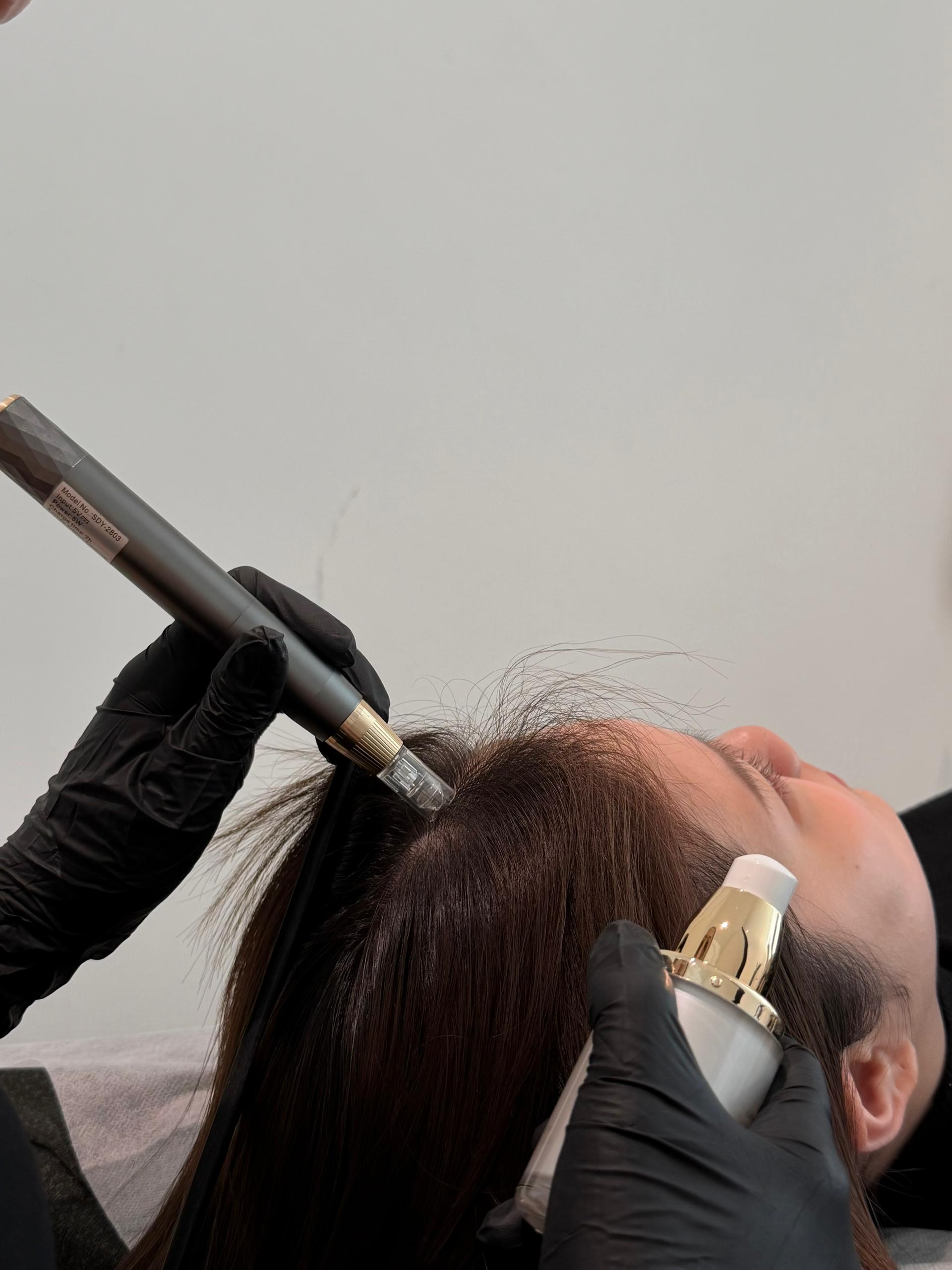 Scalp Therapy Treatment
